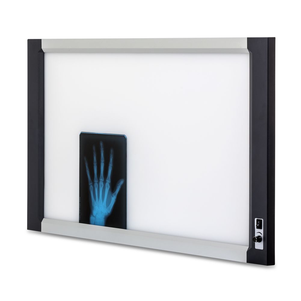 Негатоскоп Армед 2-кадровый светодиодный - Медицинское оборудование ...